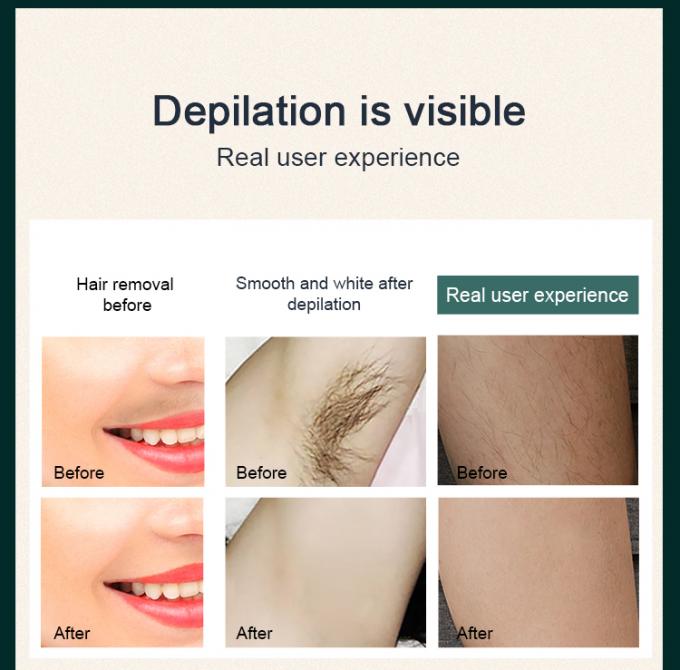 1000000 Flashes Painless Hair Removal 4.2 Cm2 IPL Laser Handset